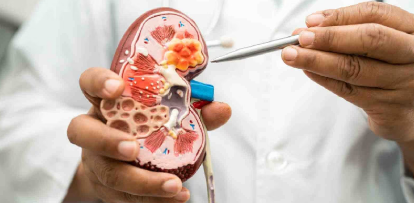 Kidney Problem