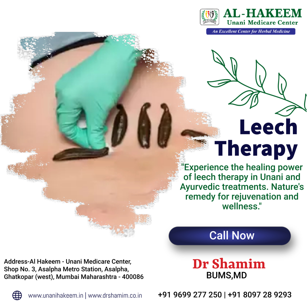 Leech Therapy "Experience the healing power of leech therapy in Unani and Ayurvedic treatments. Nature's remedy for rejuvenation and wellness."