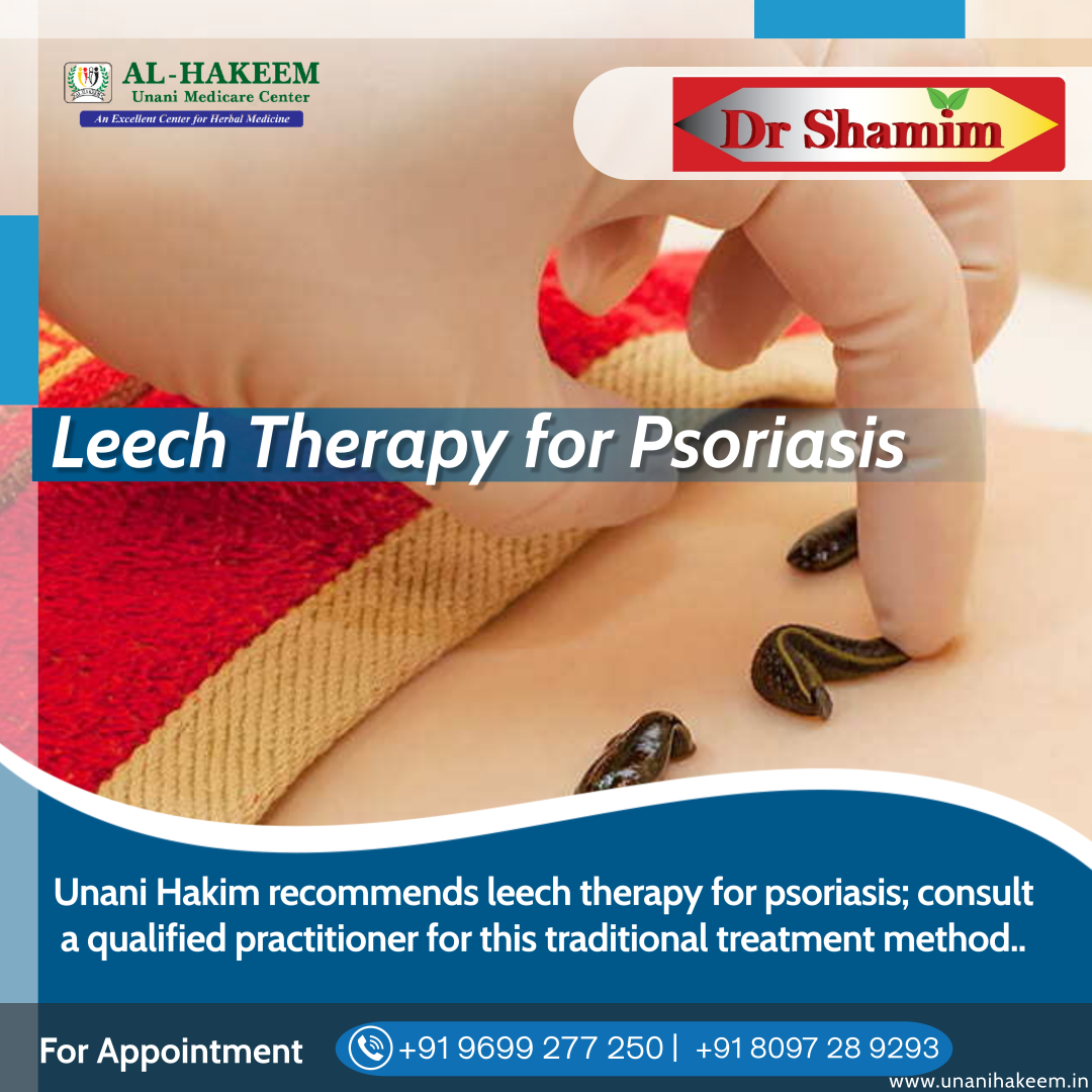 "Leech therapy is a historical practice, but its effectiveness in treating psoriasis is uncertain."