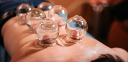 Hijama Cupping